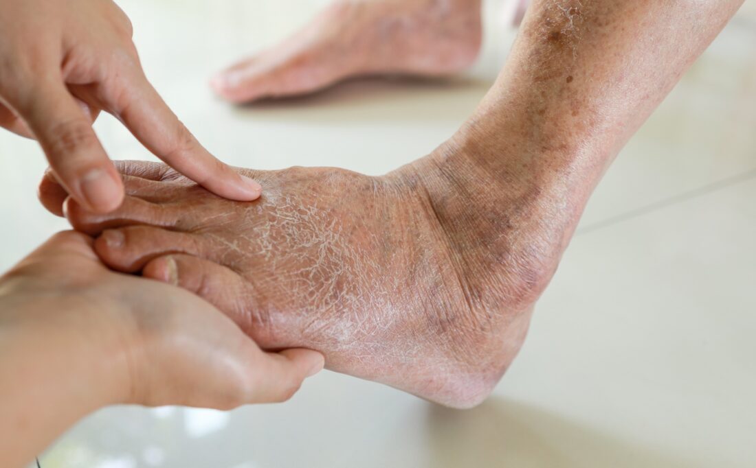 https://insulinicfl.com/wp-content/uploads/2023/09/slow-healing-wounds-1100x682.jpg?utm_source=chatgpt.com