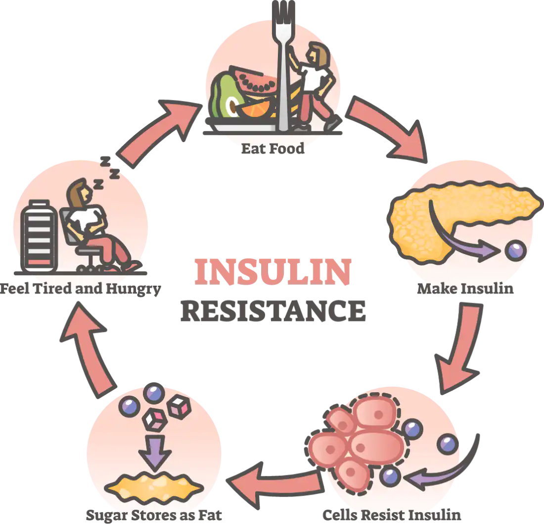 Insulin Resistance